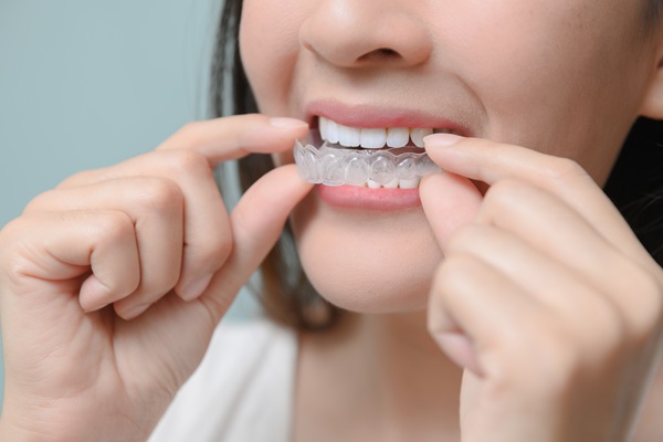 Maintaining Your Clear Aligners