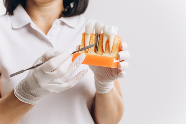 How Is A Dental Implant Placed?